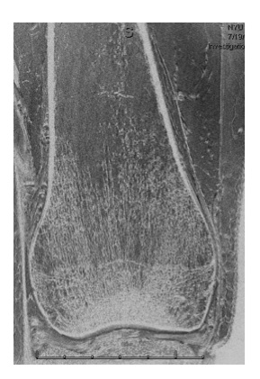 7T MRI image of my knee